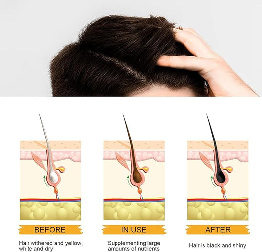 EAST MOON - Black Soap Bar Shampoo (Original) My Store